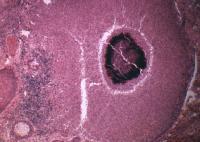 Actinomycetes Actinomycetes sulfur granule